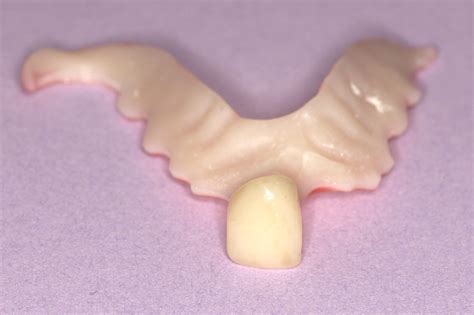 Image result for Front Teeth Partials Options