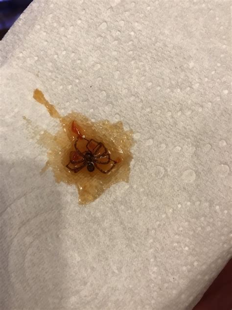 Coughing Up Mucus With Blood