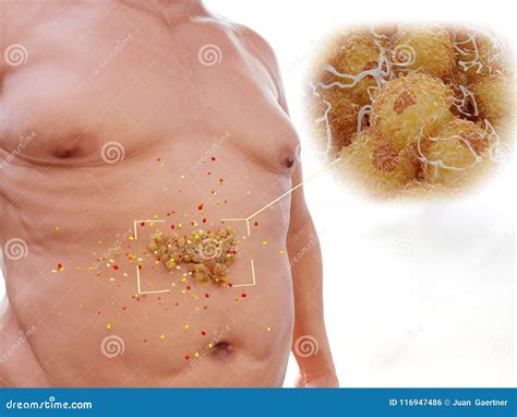 Visceral Fat is Highly Hormonally Active Stock Illustration - Illustration of abdomen, estradiol ...