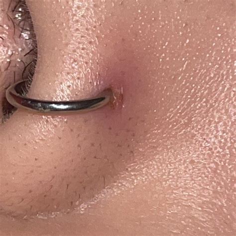 is my nostril piercing infected? : r/Legitpiercing