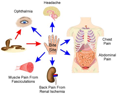 Effects Of King Cobra Venom