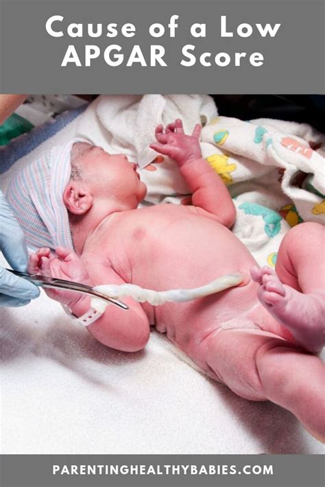 Image result for Apgar Testing