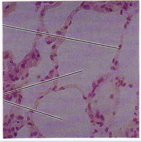 Image result for Ephilehal Tissue Sample
