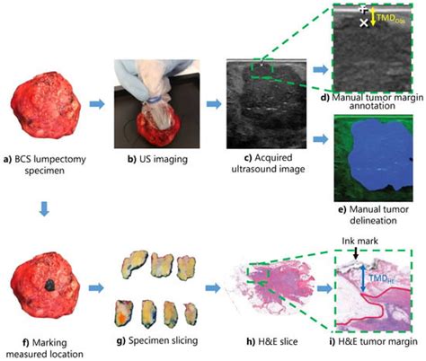 Toward Intraoperative Margin Assessment Using a Deep Learning-Based ...