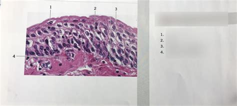 Transitional epithelium Diagram | Quizlet