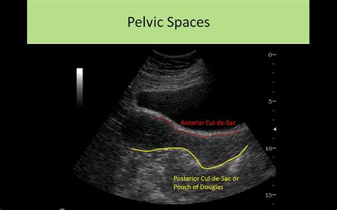 Ultrasound Registry Review - General Information