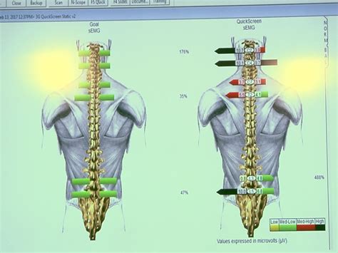 Image result for EMG Back Test