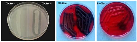 Dairy Cows’ Udder Pathogens and Occurrence of Virulence Factors in ...