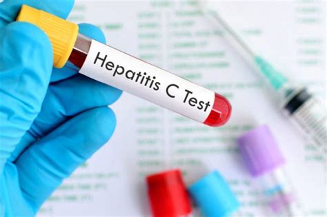 Hep C Test 的图像结果