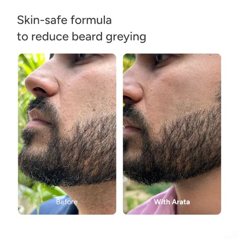 MelanoBoostª Anti-Grey Hair & Beard Serum with MelanoGrayª, Silverfree ...