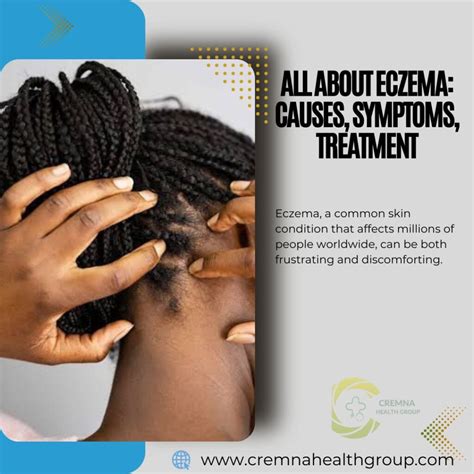 Eczema Causes Symptoms And Treatment at Jessica Stock blog