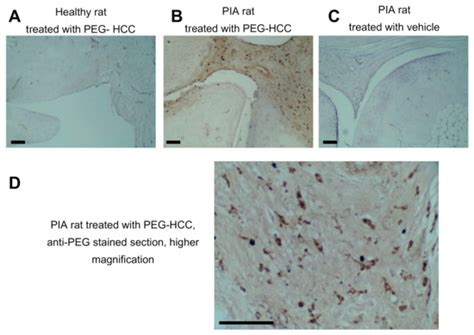 Antioxidant Carbon Nanoparticles Inhibit Fibroblast-Like Synoviocyte ...