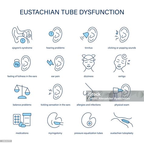 Eustachian Tube Dysfunction Symptoms Diagnostic And Treatment Vector Icon Set Medical Icons ...