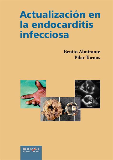 Buy Actualización en la endocarditis infecciosa Book Online at Low ...