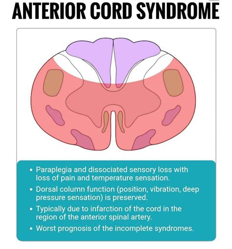 Anterior Cord Syndrome Symptoms