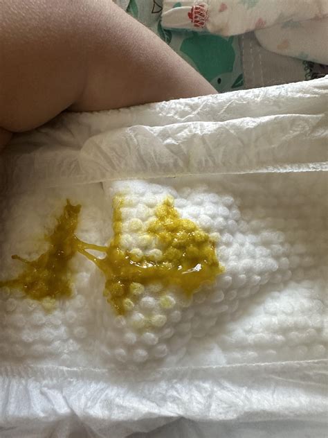 Watery Poop Newborn