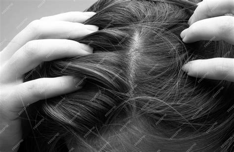 Close up of woman examining her scalp and hair hair loss on hairline or ...