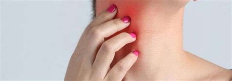 Herpes Zoster (shingles) - VEM Rental at home