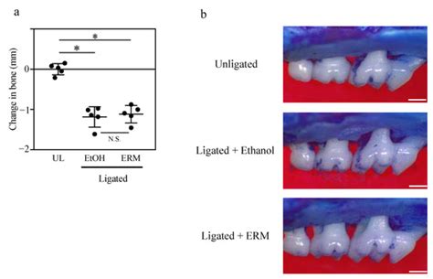 Effects of Erythromycin on Osteoclasts and Bone Resorption via DEL-1 ...
