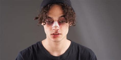 Image result for Exploding Nose