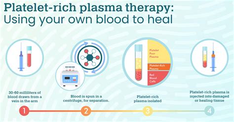 Platelet-Rich Plasma Therapy: Using Your Own Blood to Heal - Foundationhealthpartners