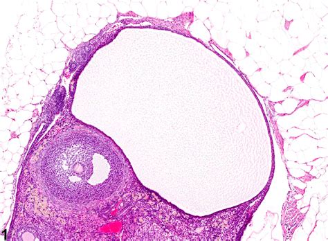 Ovary, Follicle - Cyst - Nonneoplastic Lesion Atlas
