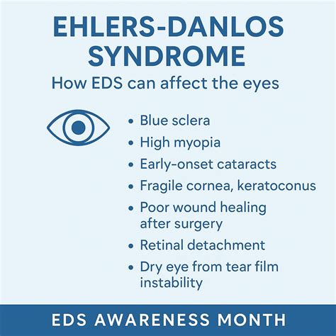 Ehler Danlos Eye