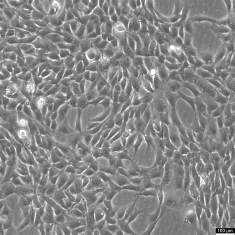 H2O2 HT22 的图像结果