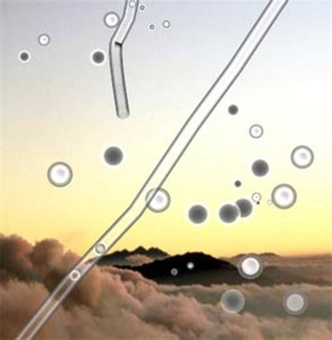 Black Dots In My Vision Floaters at Paul Coyne blog