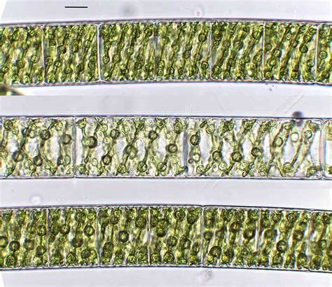 Spirogyra Under Microscope 400x Labeled