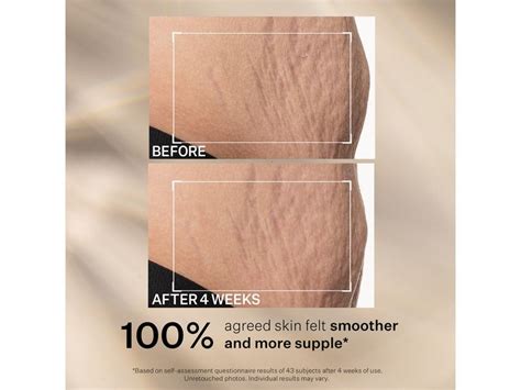 StriVectin SD Advanced Plus Intensive Moisturizer | LovelySkin