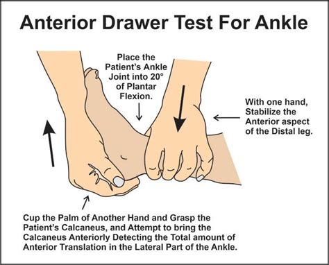 Anterior-drawer-test-ankle by austinsilva on DeviantArt