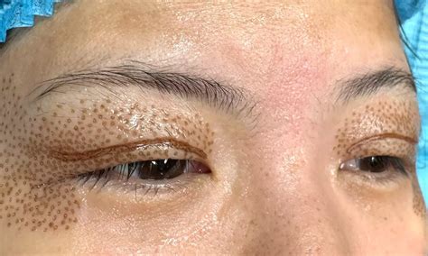 PlasmaTight n Skincare - From $196 - Sacramento | Groupon