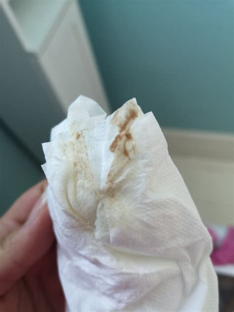Discharge On Toilet Paper After Wiping at Mitchell Trigg blog