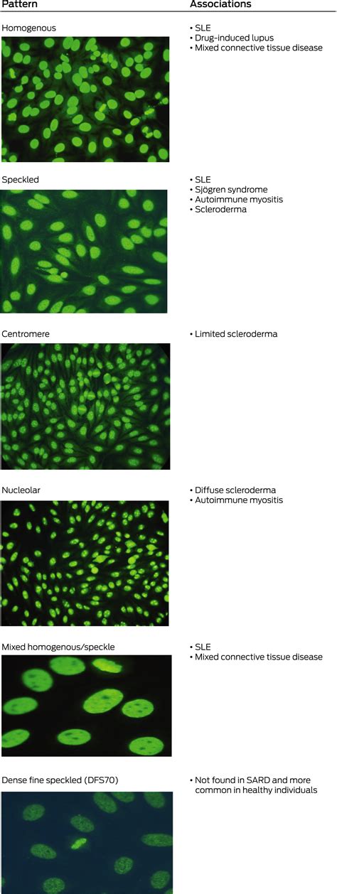 Speckled Antinuclear Antibody