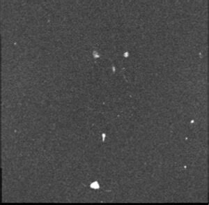 CSF Flow SCSN MRI 的图像结果