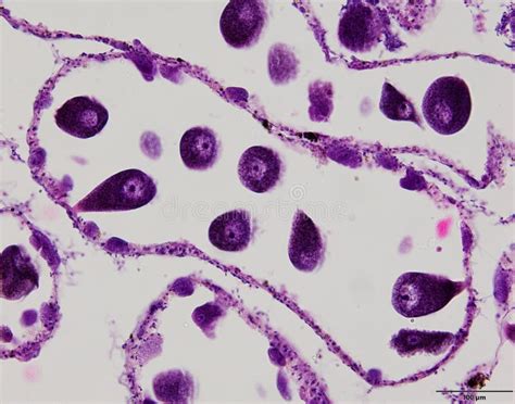 Image result for Tissue Sample Drawing Under Microscope