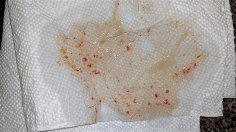 What Does Blood Look Like In Dog Vomit