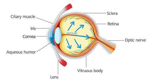Glaucoma – all you need to know about the second leading cause of blindness