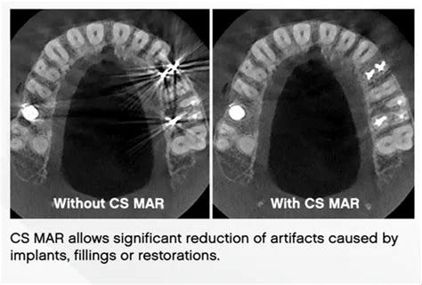 Cone Beam CT 3D CBCT - Dental Cbct Machine Trader - Retailer from Bengaluru