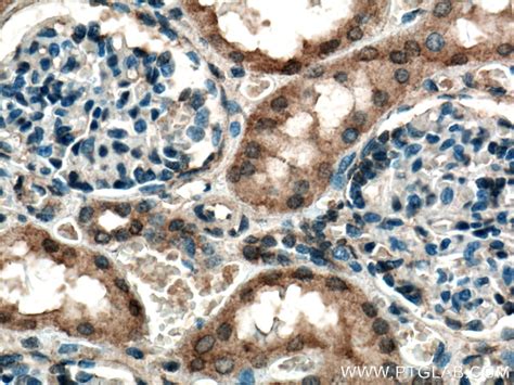 RPS6KB2 antibody (15268-1-AP) | Proteintech
