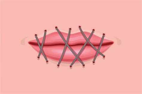 60+ Mouth Sewn Shut Stock Photos, Pictures & Royalty-Free Images - iStock