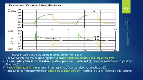 Mechanical ventilation wave forms | PPTX