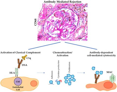 Cells | Special Issue : Macrophages in Tissue Repair, Regeneration, and ...