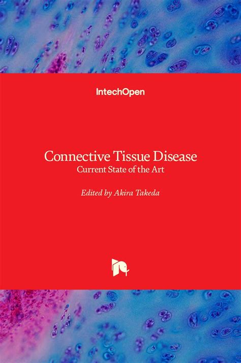 Buy Connective Tissue Disease: Current State of the Art Book Online at ...