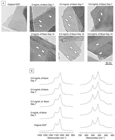 IJMS | February-1 2025 - Browse Articles
