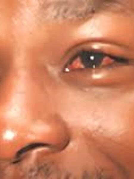 Rising road carnage on the Lira-Aduku-Apac highway sparks concern ...