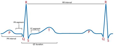 Blending Ensemble Learning Model for 12-Lead Electrocardiogram-Based ...