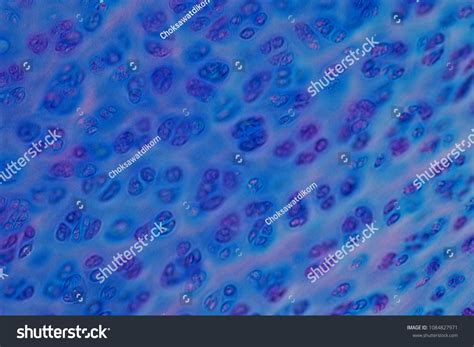 Hyaline Cartilage Under Microscope 400X at Liam Meudell blog
