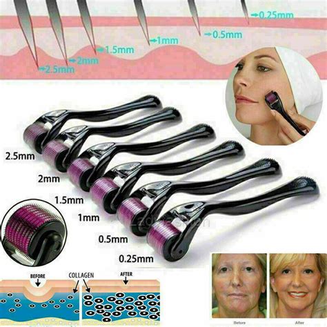 540 Derma Micro Needle Titanium Roller for Hair | Ubuy India